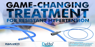 Delta® Modulator Renal Denevration for Hypertension